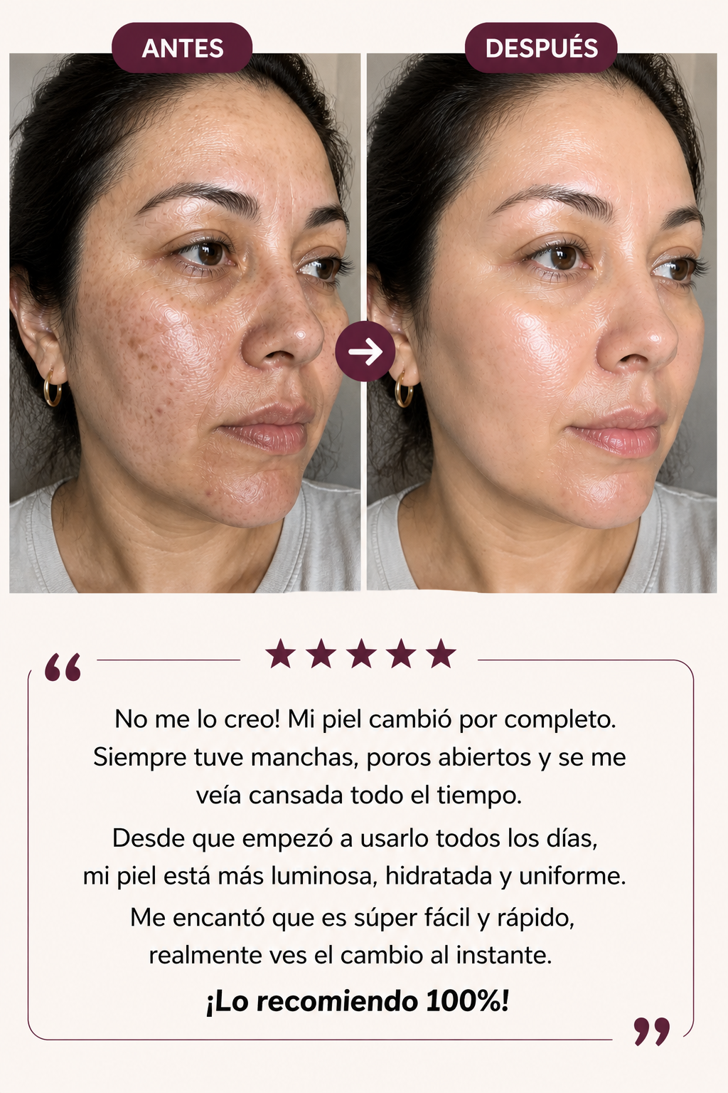 Elimina arrugas y revela tu mejor piel desde hoy – LUMORA